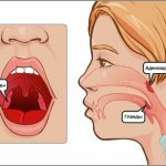 Sinusitis. Symptoms and treatment in adults with folk remedies, antibiotics, drops 