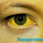 Гепатит А симптомы желтухи