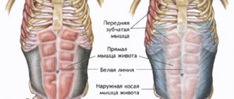 Hernia of the white line of the abdomen