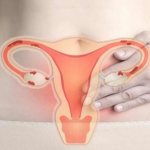 Treatment of endometriosis in women - the most effective methods