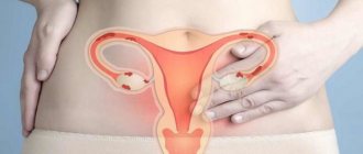 Лечение эндометриоза у женщин – самые эффективные методы