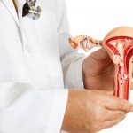 treatment of uterine cancer in Europe