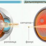 Механизм фокусировки зрения на сетчатку