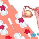 Menstruation with an ovarian cyst: delay, pain, how it comes out, how many days, removal