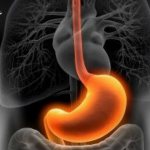 Can chronic gastritis free you from the army?