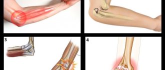 pathologies of the elbow joint