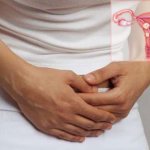 Signs and symptoms of uterine fibroids