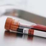 Test tube with blood