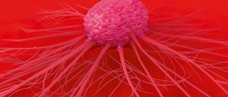 Рак груди 1 стадии: лечение и профилактика