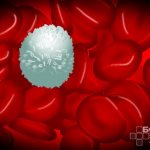 Рак крови — бесконтрольное деление и мутация кроветворных клеток, клеток костного мозга и клеток лимфатической системы