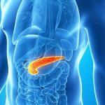 Reactive pancreatitis is an acute, aseptic inflammation of the pancreas tissue caused by pathology of other digestive organs.
