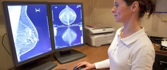Digital mammography result