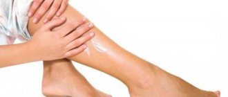 List of the best ointments for swelling after a fracture