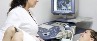 Ultrasound of the uterus and appendages: how to prepare for this procedure