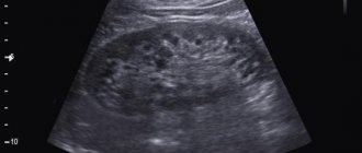Ultrasound of the liver: how to properly prepare for the procedure