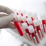 types of blood tests