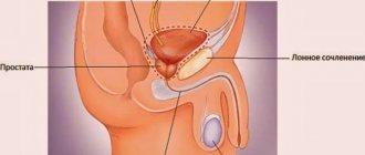 Inflammation of the genitourinary system in men: symptoms, treatment