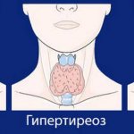 Thyroid diseases