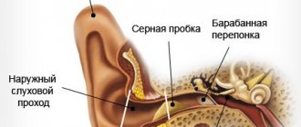 Заложенность в ушах. Причины и лечение шума, звона, боли в горле, при насморке, от удара, после сна. Чем капать